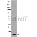 DF8225 at 1/100 staining Rat liver tissue by IHC-P. The sample was formaldehyde fixed and a heat mediated antigen retrieval step in citrate buffer was performed. The sample was then blocked and incubated with the antibody for 1.5 hours at 22¡ãC. An HRP conjugated goat anti-rabbit antibody was used as the secondary