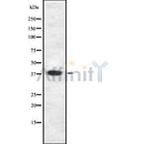 Western blot analysis SSTR5 using LOVO whole cell lysates