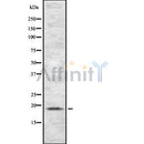 Western blot analysis of extracts from various samples, using TSPO Antibody.
 Lane 1: Mouse spleen treated with blocking peptide;
 Lane 2: Mouse spleen;
 Lane 3: HepG2;
 Lane 4: 3T3;
 Lane 5: Hela.