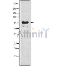 Western blot analysis of RIPK1 using HeLa whole cell lysates