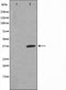 AF2002 staining MCF7 by IF/ICC. The sample were fixed with PFA and permeabilized in 0.1% Triton X-100,then blocked in 10% serum for 45 minutes at 25¡ãC. The primary antibody was diluted at 1/200 and incubated with the sample for 1 hour at 37¡ãC. An  Alexa Fluor 594 conjugated goat anti-rabbit IgG (H+L) Ab, diluted at 1/600, was used as the secondary antibod