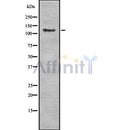 Western blot analysis of CD163 using Jurkat whole cell lysates