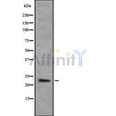 Western blot analysis of COPS8 using Jurkat whole cell lysates