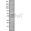 DF8241 at 1/100 staining Mouse spleen tissue by IHC-P. The sample was formaldehyde fixed and a heat mediated antigen retrieval step in citrate buffer was performed. The sample was then blocked and incubated with the antibody for 1.5 hours at 22¡ãC. An HRP conjugated goat anti-rabbit antibody was used as the secondary