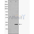 DF8243 at 1/100 staining Mouse lung tissue by IHC-P. The sample was formaldehyde fixed and a heat mediated antigen retrieval step in citrate buffer was performed. The sample was then blocked and incubated with the antibody for 1.5 hours at 22¡ãC. An HRP conjugated goat anti-rabbit antibody was used as the secondary