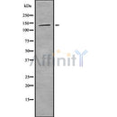 Western blot analysis of TIMELESS using COLO205 whole cell lysates