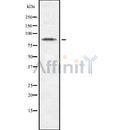 Western blot analysis of CDH10 using Jurkat whole cell lysates