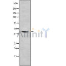 DF8258 at 1/100 staining Human kidney tissue by IHC-P. The sample was formaldehyde fixed and a heat mediated antigen retrieval step in citrate buffer was performed. The sample was then blocked and incubated with the antibody for 1.5 hours at 22¡ãC. An HRP conjugated goat anti-rabbit antibody was used as the secondary
