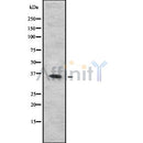 Western blot analysis of extracts from Mouse brain, using NEK6 Antibody. The lane on the left was treated with blocking peptide.