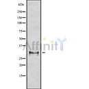 DF8260 at 1/100 staining Human Melanoma tissue by IHC-P. The sample was formaldehyde fixed and a heat mediated antigen retrieval step in citrate buffer was performed. The sample was then blocked and incubated with the antibody for 1.5 hours at 22¡ãC. An HRP conjugated goat anti-rabbit antibody was used as the secondary