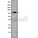 DF8266 at 1/100 staining Mouse kidney tissue by IHC-P. The sample was formaldehyde fixed and a heat mediated antigen retrieval step in citrate buffer was performed. The sample was then blocked and incubated with the antibody for 1.5 hours at 22¡ãC. An HRP conjugated goat anti-rabbit antibody was used as the secondary