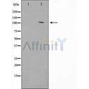 Western blot analysis of JAG1 Antibody expression in Mouse liver tissue lysates.