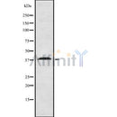 Western blot analysis of extracts from HepG2 cells, using SLC9A3R1 Antibody. The lane on the left was treated with blocking peptide.