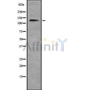 Western blot analysis of WAPAL using Jurkat whole cell lysates
