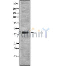 Western blot analysis of PSMA7 using HeLa whole cell lysates