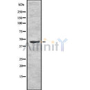 Western blot analysis of RCC1 using RAW264.7 whole cell lysates