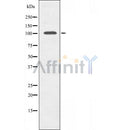 Western blot analysis of TPO using HuvEc whole cell lysates