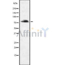 DF8286 staining HepG2 cells by IF/ICC. The sample were fixed with PFA and permeabilized in 0.1% Triton X-100,then blocked in 10% serum for 45 minutes at 25¡ãC. The primary antibody was diluted at 1/200 and incubated with the sample for 1 hour at 37¡ãC. An  Alexa Fluor 594 conjugated goat anti-rabbit IgG (H+L) antibody(Cat.