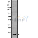 Western blot analysis of RETN using Jurkat whole cell lysates