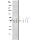 Western blot analysis of CDC123 using COLO205 whole cell lysates