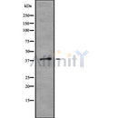 DF8290 at 1/100 staining Rat colon tissue by IHC-P. The sample was formaldehyde fixed and a heat mediated antigen retrieval step in citrate buffer was performed. The sample was then blocked and incubated with the antibody for 1.5 hours at 22¡ãC. An HRP conjugated goat anti-rabbit antibody was used as the secondary