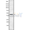 DF8295 at 1/100 staining Rat liver tissue by IHC-P. The sample was formaldehyde fixed and a heat mediated antigen retrieval step in citrate buffer was performed. The sample was then blocked and incubated with the antibody for 1.5 hours at 22¡ãC. An HRP conjugated goat anti-rabbit antibody was used as the secondary