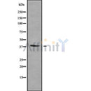 DF8299 at 1/100 staining Human pancreas tissue by IHC-P. The sample was formaldehyde fixed and a heat mediated antigen retrieval step in citrate buffer was performed. The sample was then blocked and incubated with the antibody for 1.5 hours at 22¡ãC. An HRP conjugated goat anti-rabbit antibody was used as the secondary