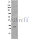 Western blot analysis of MYL4 using HeLa whole cell lysates