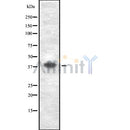 Western blot analysis GDF3 using Jurkat whole cell lysates