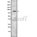 DF8310 at 1/100 staining Mouse lung tissue by IHC-P. The sample was formaldehyde fixed and a heat mediated antigen retrieval step in citrate buffer was performed. The sample was then blocked and incubated with the antibody for 1.5 hours at 22¡ãC. An HRP conjugated goat anti-rabbit antibody was used as the secondary