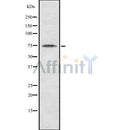 Western blot analysis of extracts from B16F10, using ABCD3 Antibody. Lane 1 was treated with the blocking peptide.
