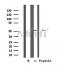 Western blot analysis of extracts from 293, using KRT12 Antibody.