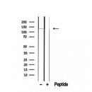 DF8323 at 1/100 staining Human liver cancer tissue by IHC-P. The sample was formaldehyde fixed and a heat mediated antigen retrieval step in citrate buffer was performed. The sample was then blocked and incubated with the antibody for 1.5 hours at 22¡ãC. An HRP conjugated goat anti-rabbit antibody was used as the secondary