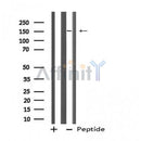 Western blot analysis of ZFYVE9 using HeLa whole cell lysates