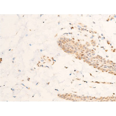 AF3001 staining HeLa by IF/ICC. The sample were fixed with PFA and permeabilized in 0.1% Triton X-100,then blocked in 10% serum for 45 minutes at 25¡ãC. The primary antibody was diluted at 1/200 and incubated with the sample for 1 hour at 37¡ãC. An  Alexa Fluor 594 conjugated goat anti-rabbit IgG (H+L) Ab, diluted at 1/600, was used as the secondary antibod