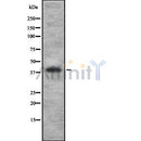 DF8330 at 1/100 staining Human Melanoma tissue by IHC-P. The sample was formaldehyde fixed and a heat mediated antigen retrieval step in citrate buffer was performed. The sample was then blocked and incubated with the antibody for 1.5 hours at 22¡ãC. An HRP conjugated goat anti-rabbit antibody was used as the secondary