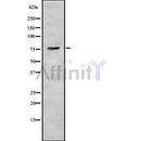 Western blot analysis of BDKRB2 using HuvEc whole cell lysates