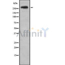 DF8341 staining  COLO205 cells by IF/ICC. The sample were fixed with PFA and permeabilized in 0.1% Triton X-100,then blocked in 10% serum for 45 minutes at 25¡ãC. The primary antibody was diluted at 1/200 and incubated with the sample for 1 hour at 37¡ãC. An  Alexa Fluor 594 conjugated goat anti-rabbit IgG (H+L) antibody(Cat.
