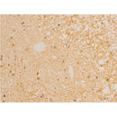 AF3002 staining Hela by IF/ICC. The sample were fixed with PFA and permeabilized in 0.1% Triton X-100,then blocked in 10% serum for 45 minutes at 25¡ãC. The primary antibody was diluted at 1/200 and incubated with the sample for 1 hour at 37¡ãC. An  Alexa Fluor 594 conjugated goat anti-rabbit IgG (H+L) Ab, diluted at 1/600, was used as the secondary antibod