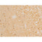 AF3002 staining Hela by IF/ICC. The sample were fixed with PFA and permeabilized in 0.1% Triton X-100,then blocked in 10% serum for 45 minutes at 25¡ãC. The primary antibody was diluted at 1/200 and incubated with the sample for 1 hour at 37¡ãC. An  Alexa Fluor 594 conjugated goat anti-rabbit IgG (H+L) Ab, diluted at 1/600, was used as the secondary antibod
