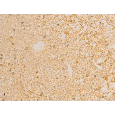 AF3002 staining Hela by IF/ICC. The sample were fixed with PFA and permeabilized in 0.1% Triton X-100,then blocked in 10% serum for 45 minutes at 25¡ãC. The primary antibody was diluted at 1/200 and incubated with the sample for 1 hour at 37¡ãC. An  Alexa Fluor 594 conjugated goat anti-rabbit IgG (H+L) Ab, diluted at 1/600, was used as the secondary antibod