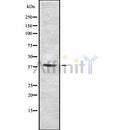 Western blot analysis SETD7 using Jurkat whole cell lysates