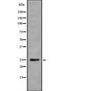 Western blot analysis of DDIT4 using Jurkat whole cell lysates