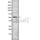 Western blot analysis of CAP2 using K562 whole cell lysates
