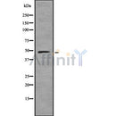 DF8358 at 1/100 staining Rat brain tissue by IHC-P. The sample was formaldehyde fixed and a heat mediated antigen retrieval step in citrate buffer was performed. The sample was then blocked and incubated with the antibody for 1.5 hours at 22¡ãC. An HRP conjugated goat anti-rabbit antibody was used as the secondary