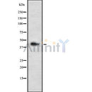 Western blot analysis of LHX3 using HepG2 whole cell lysates