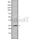 Western blot analysis of EBI3 using COLO205 whole cell lysates