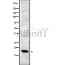 Western blot analysis of ALOX5AP using HepG2 whole cell lysates