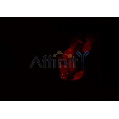 AF0184 staining Hela by IF/ICC. The sample were fixed with PFA and permeabilized in 0.1% Triton X-100,then blocked in 10% serum for 45 minutes at 25¡ãC. The primary antibody was diluted at 1/200 and incubated with the sample for 1 hour at 37¡ãC. An  Alexa Fluor 594 conjugated goat anti-rabbit IgG (H+L) Ab, diluted at 1/600, was used as the secondary antibod