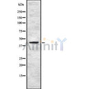 Western blot analysis of MEIS1 using Jurkat whole cell lysates